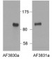 HIC1 (aa193-204) Antibody (internal region)