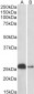 calbindin D28 Antibody (internal region)