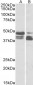 perilipin 3 / TIP47 (aa154-167) Antibody (internal region)