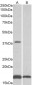 CD57 / B3GAT1 Antibody (internal region)