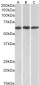 MMP14 Antibody (internal region)