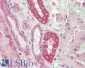 CAPN1 Antibody (internal region)