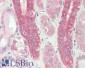 CAPN1 (aa468-481) Antibody (internal region)