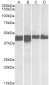 creatine kinase M-type Antibody (N-Term)