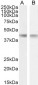 creatine kinase M-type (aa258-270) Antibody (internal region)