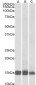 FABP3 Antibody (internal region)