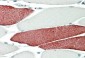 TNNT3 Antibody (C-Term)