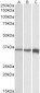 TNNT3 Antibody (C-Term)