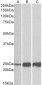 TNNI2 Antibody (N-Term)