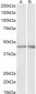NPHS2 / SRN1 Antibody (C-Term)