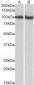 CLOCK (aa458-472) Antibody (internal region)