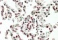 HOXB6 Antibody (internal region)