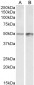 Transcription factor E2F4 Antibody (internal region)