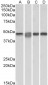 MAP2K2 / MEK2 Antibody (internal region)