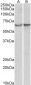 alpha-1-antichymotrypsin (aa222-236) Antibody (internal region)