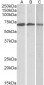 OAS2 (aa357-371) Antibody (internal region)