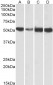 ATP5A1 Antibody (internal region, near N-Term)