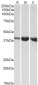 ALDOA Antibody (internal region, near N-Term)