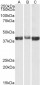 ALDOA (aa86-96) Antibody (internal region)