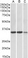 LDHA Antibody (C-Term)