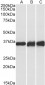 LDHB  Antibody (internal region, near C-Term)