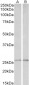 peroxiredoxin 6 Antibody (internal region, near N-Term)