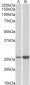 peroxiredoxin 6 (aa170-180) Antibody (internal region)