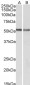 Tropomyosin 4 / TPM4 Antibody (C-Term)