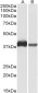 CAPG (aa205-217) Antibody (internal region)