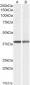 CAPG (aa205-217) Antibody (internal region)