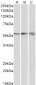 ATP5B (aa15162) Antibody (internal region)
