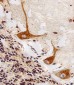 PPT1 Antibody (C-term)