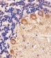 PPT1 Antibody (C-term)