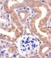 RPS6 Antibody (N-term)