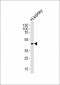 CPM Antibody (Center)