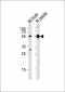 TUBA1C Antibody (C-term)