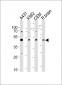 SUV39H2 Antibody (C-term)