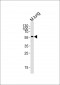 M Mlkl Antibody (C-term)