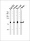 VILIP1 Antibody (C-term)