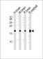 VILIP1 Antibody (C-term)