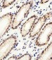 Cellular Apoptosis Susceptibility Antibody (C-term)