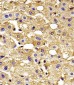 HBG2 Antibody (C-term)