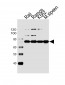 BTK Antibody (Center)