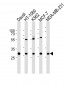 PNP Antibody (Center)