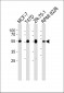 ZDHHC11 Antibody (C-term)