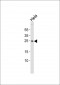 ZNRF2 Antibody (N-term)