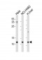 UQCRQ Antibody (N-term)