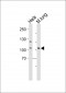 Mouse Epha4 Antibody (Center)