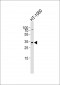 ARPC2 Antibody (C-term)