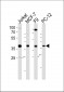 Human-FOSL2 (Y83) Antibody